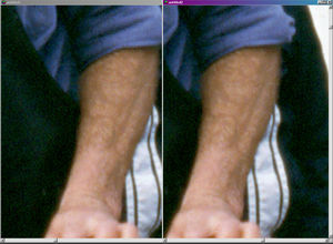 Interpolation of the same slide by Photo-Brush, left, and the PrimeFilm scanner, right.